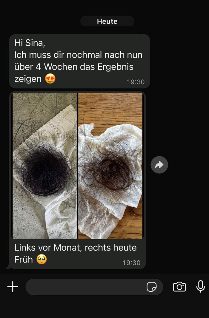 Haarausfall vorher/nachher – Kundin von Sina, MONAT IR Clinical