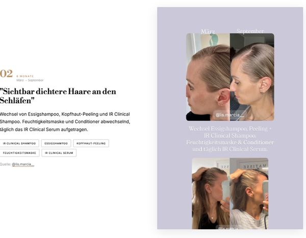 Sichtbar dichtere Haare an den Schläfen · 8 Monate