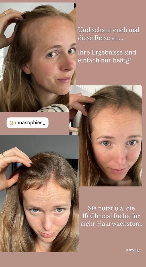 Mehr Haarwachstum mit der IR Clinical Reihe